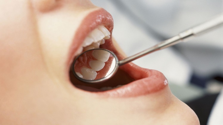 Common Dental Problems and How to Prevent Them