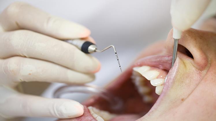 What to Expect During a Visit to the Periodontist