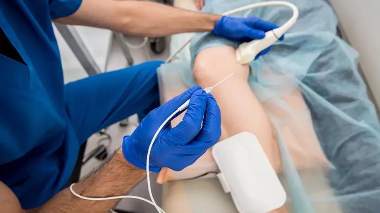 Radia frequency ablation – What are the benefits?