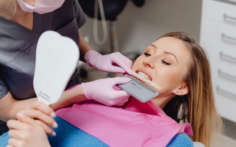 Dental Veneers: A Comprehensive Guide
